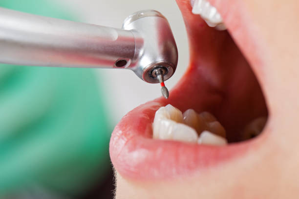 Best After-Hours Dental Trauma Care in Pecan Grove, TX